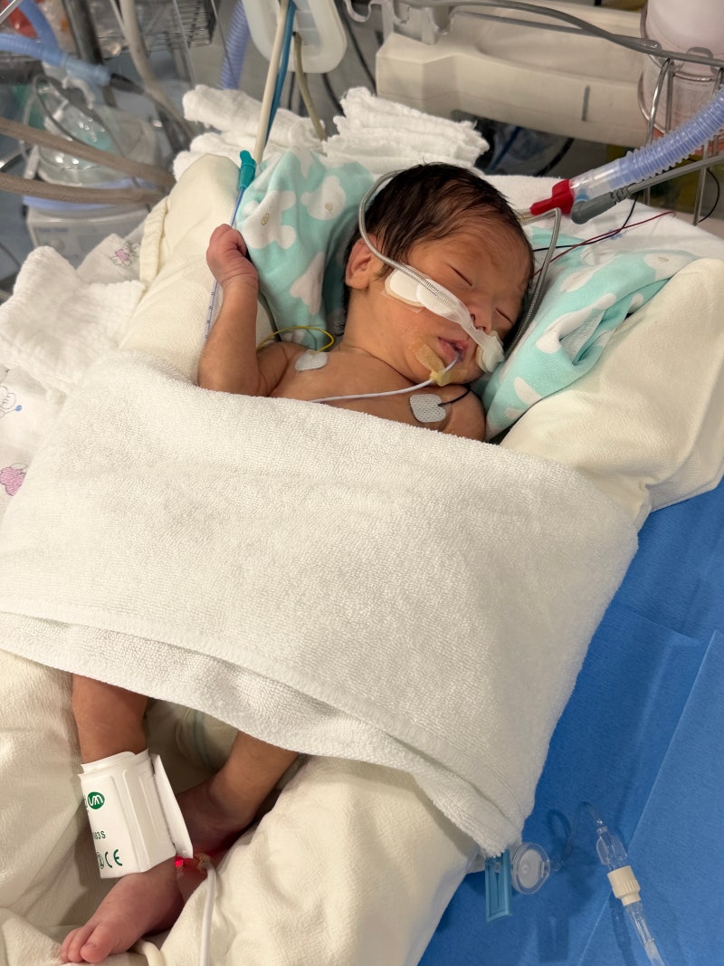 #2 분당서울대병원 신생아 호흡곤란 증후군 NICU 일기