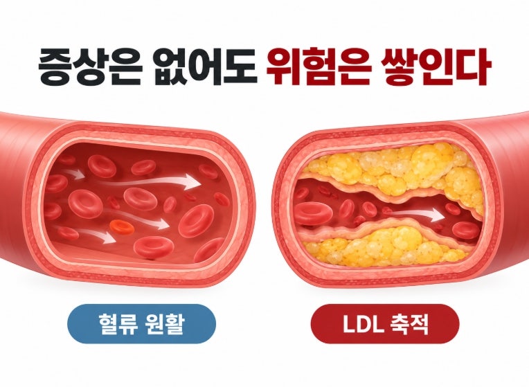 고지혈증은 병이 아니라던데…그럼 왜 약까지 먹어야 할까?
