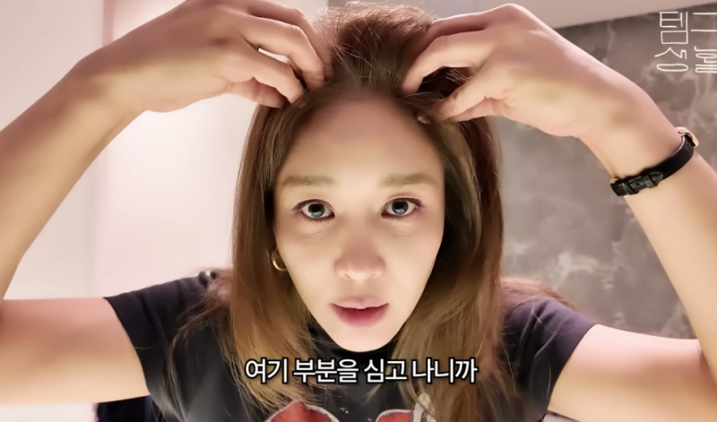 "헤어라인 이식했더니 OOO이 사라졌다?" 부작용 고백한 옥주현 모발이식