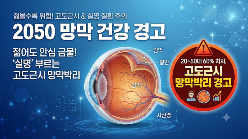 망막박리 증상 60%가 20~50대… 고도근시 위험성과 3대 전조증상 정리