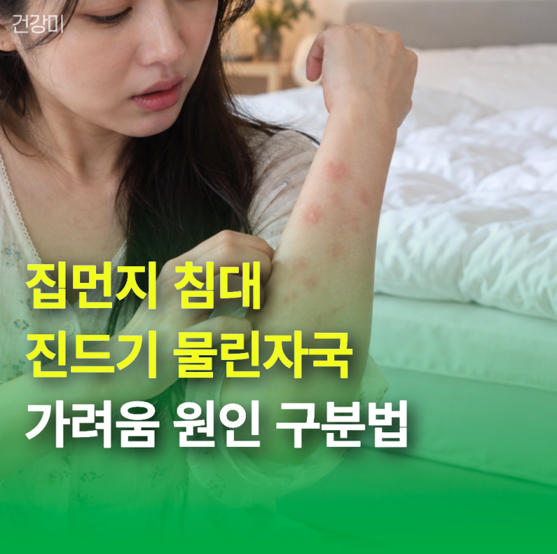 집먼지 침대 진드기 물린자국 "모기와 다를까?" 가려움 원인 구분법 3가지