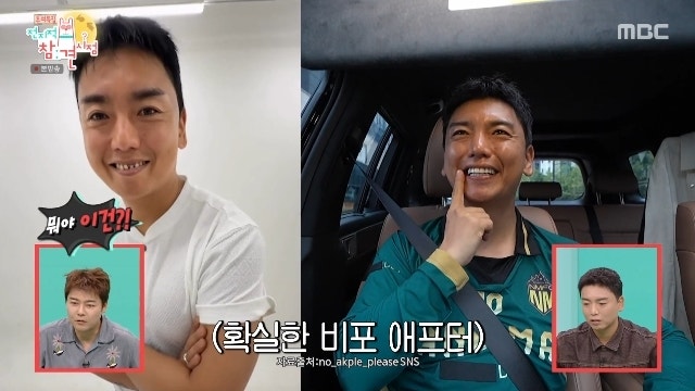 곽범, 수천만원 치아 시술 전 공개…전참시서 밝힌 관리 비결은?