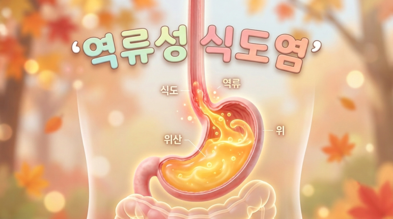 방송인 신기루 역류성 식도염! 명절 후 속쓰림 원인과 관리법