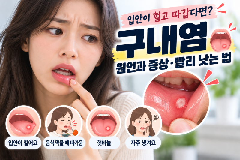 입안이 헐고 따끔거린다면? 구내염 원인과 증상·빨리 낫는 법