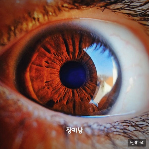 망막박리 증상 원인 수술비 관리법 좋은 음식