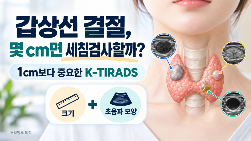 갑상선 결절이 몇 cm면 세침검사를 하나요? 1cm보다 중요한 K-TIRADS 기준
