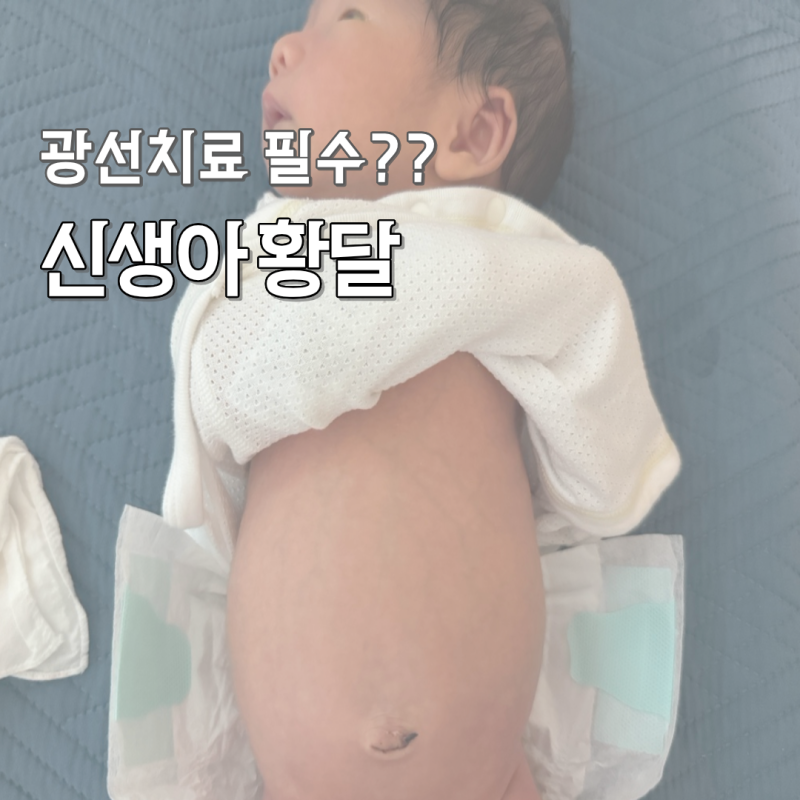 신생아 황달 수치 18 광선치료 후기와 모유수유 중단 여부까지 총정리