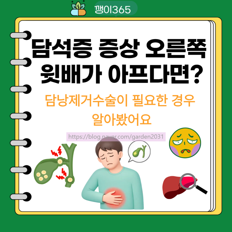 담석증 증상 오른쪽 윗배가 아프다면?담낭제거수술이 필요한 경우 알아봤어요