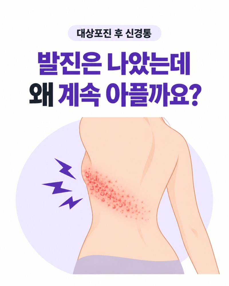 대상포진 후 신경통, 발진은 나았는데 왜 계속 아플까요?