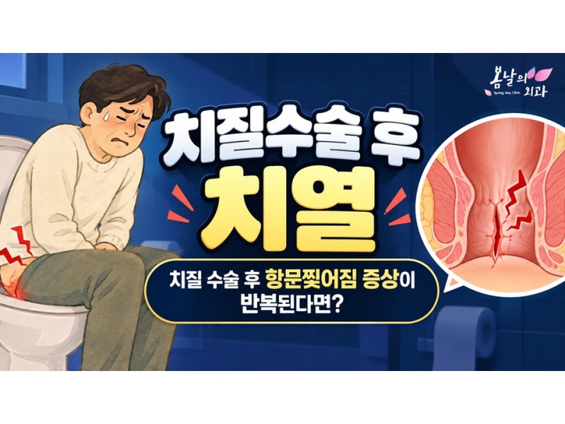 치질수술 후 치열 치료 따로? 치핵 치열 동시에 수술 가능합니다.