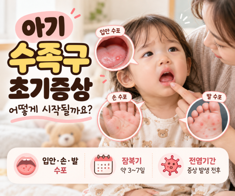 아기 수족구 초기증상 입안 손발 수포 잠복기 전염기간 어린이집 등원 시기