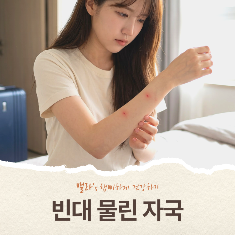 빈대 물린자국 및 퇴치 방법, 모양만 보고 모기랑 구분하면 안 되는 이유