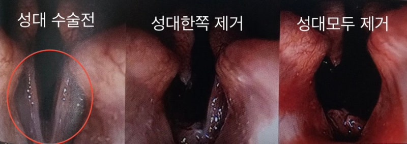 강아지 성대제거수술 | 짖음이 심한 강아지 비절개식 성대수술 사례