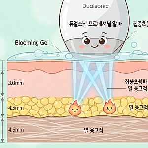 피부과 대신 집에서! 듀얼소닉 프로페셔널 알파 내돈내산 2달 솔직 후기 (효과, 사용법, 통증)