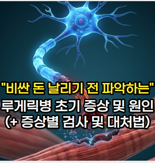루게릭병 의심될 때 "돈 날리기 전 파악하는" 루게릭병 초기 증상 및 원인 (+ 증상별 검사 및 ....