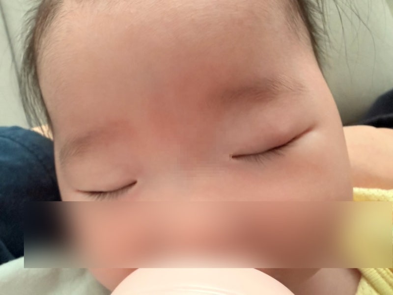 [D+165] 콩다래끼의 습격