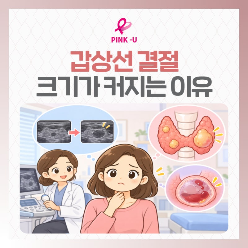 세종갑상선검진 갑상선결절 크기가 커지는 이유