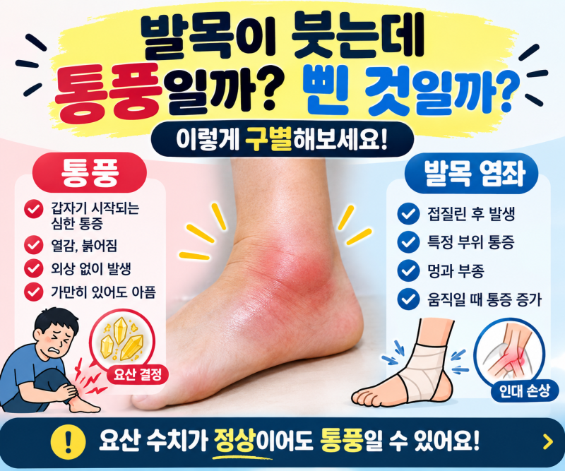 발목이 붓는데 통풍인지 삔 것인지 구별하는 방법