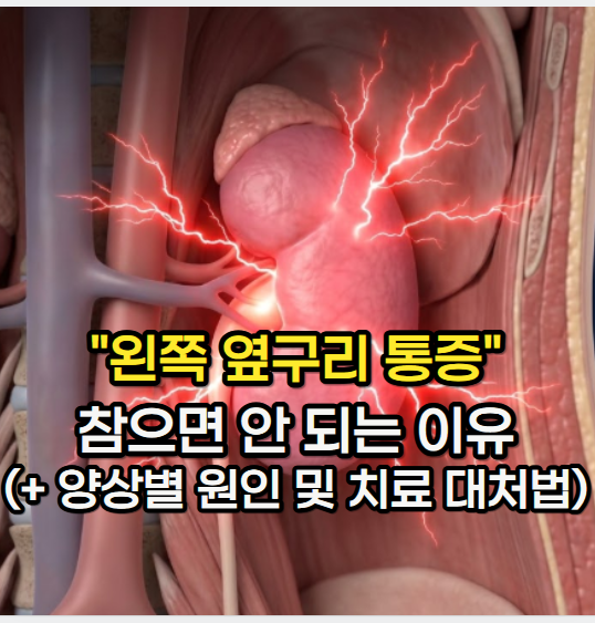 "왼쪽 옆구리 통증"을 참으면 안 되는 이유(+ 통증 양상별 원인 및 치료 대처법, 신우신염 증....