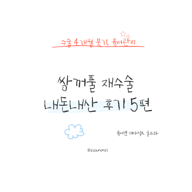 쌍꺼풀 재수술 후기5: 수술후 4개월 붓기빠짐, 쌍꺼풀 흉터관리