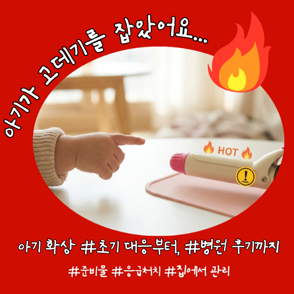 아기 고데기 화상, 갑자기 손을 뻗었어요 ‼️｜화상 직후 응급처치와 병원 후기
