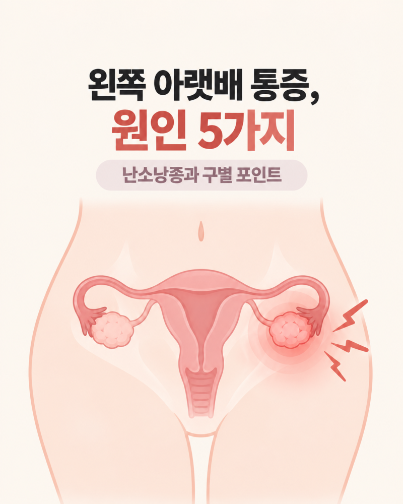 왼쪽 아랫배 통증 원인 5가지, 난소낭종 증상과 구별 포인트