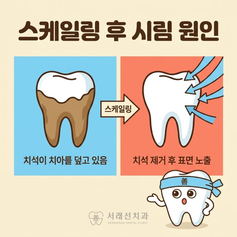 스케일링 후 이가 시려요정상인가요?