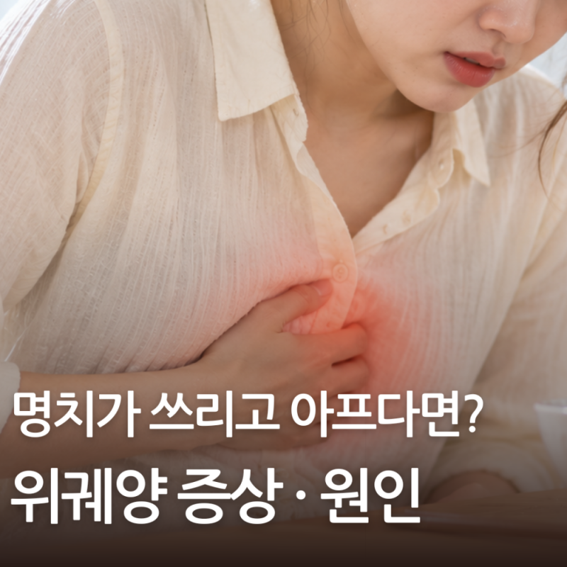 위궤양 증상 및 원인 명치 통증 속쓰림 나타난다면?