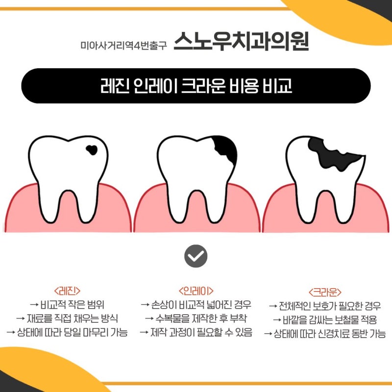 충치치료 비용 레진 인레이 크라운 언제 필요할까요?