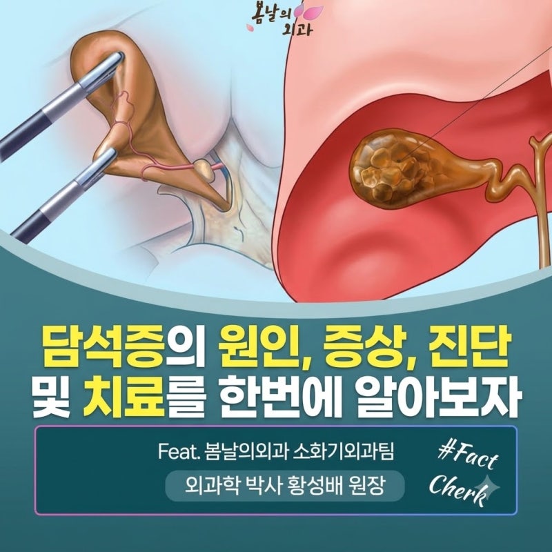 담석증의 원인, 증상, 진단 및 치료에 대해 한방에 정리해보자.