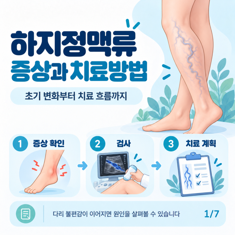 하지정맥류 초기증상과 치료방법｜검사부터 수술까지 살펴보기