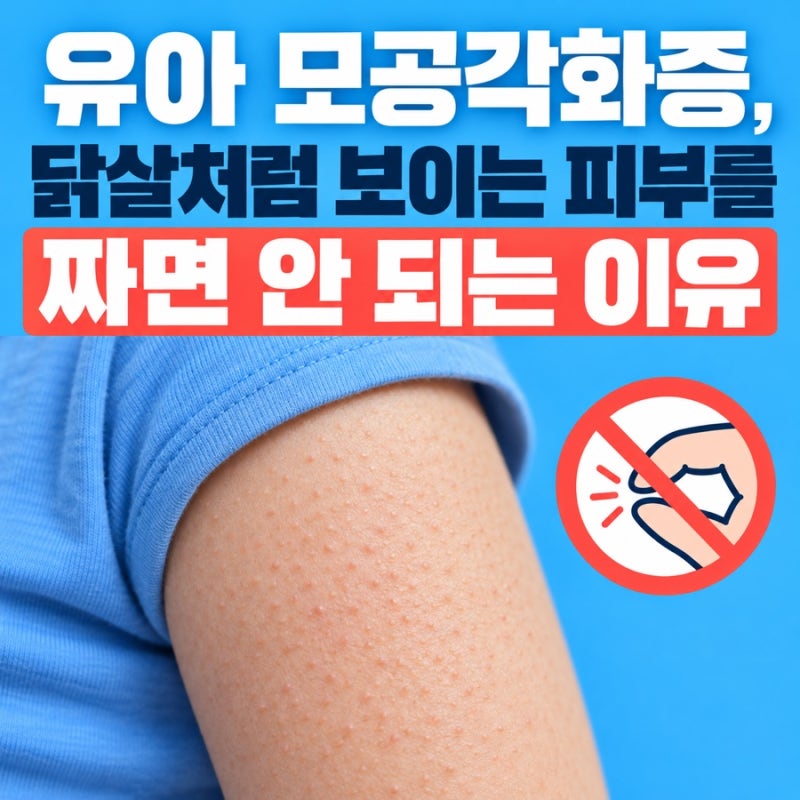 유아 모공각화증, 닭살처럼 보이는 피부를 짜면 안 되는 이유
