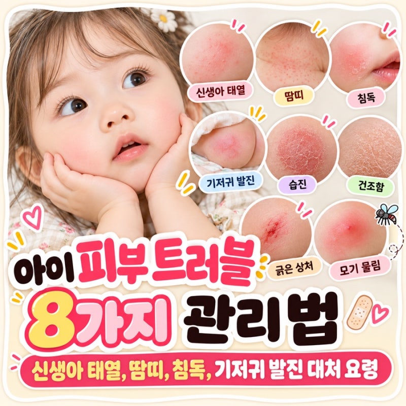 아이 피부 트러블 8가지 관리법 | 신생아 태열, 땀띠, 침독, 기저귀 발진 대처 요령