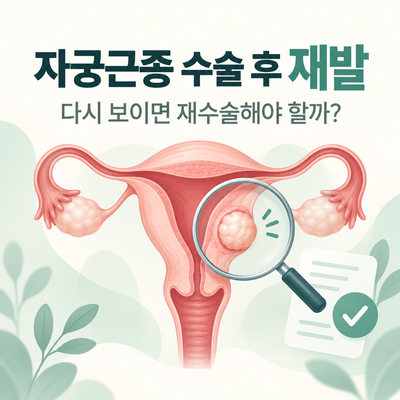 자궁근종 수술 후 재발률｜다시 생기는 이유·재수술 기준·예방 가능할까?