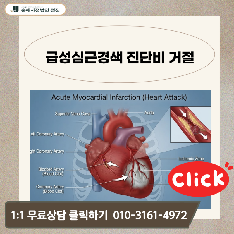 급성심근경색 진단비 거절, I21 질병코드 추정 진단서인데 정말 못 받을까?