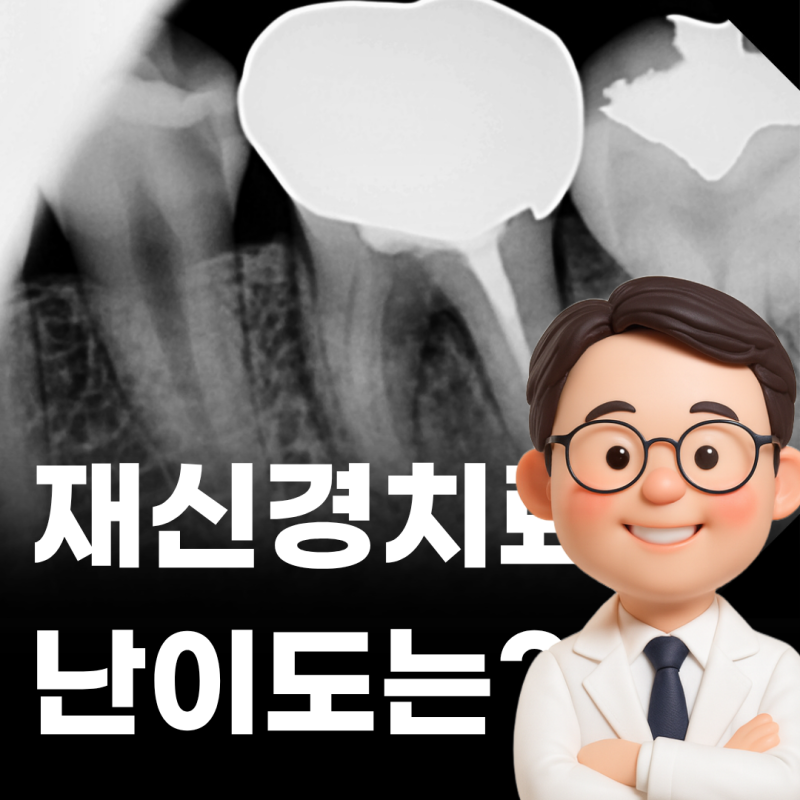신경치료한 어금니 다시 아플 때, 임플란트 전 확인할 것