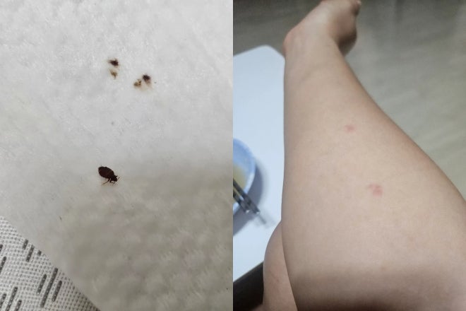빈대 물린자국 모양, 모기랑 헷갈릴 때 확인해야 할 특징과 초기 대처법