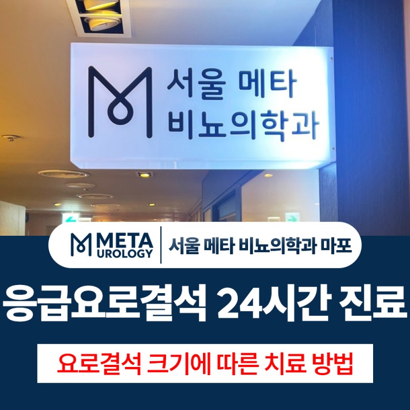 용산비뇨기과 요로결석 크기에 따라 치료 방법이 달라지는 이유는