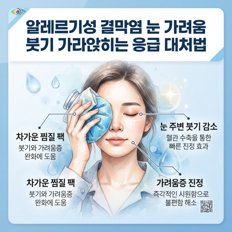 알레르기성 결막염 눈 가려움 붓기 가라앉히는 응급 대처법