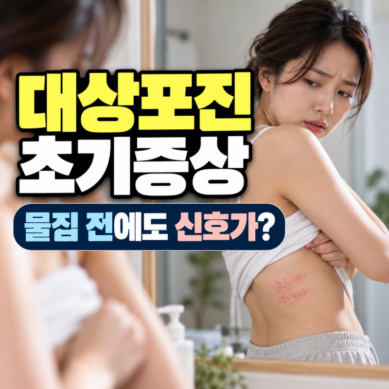 대상포진 초기증상, 간지러움·통증부터 얼굴·등에 나타나는 신호