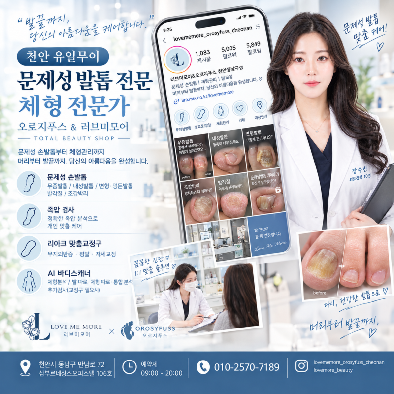 “병원 가야 하나? 네일샵 가야 하나?” 천안 문제성발톱 고민이라면 먼저 확인하세요 - 러브....