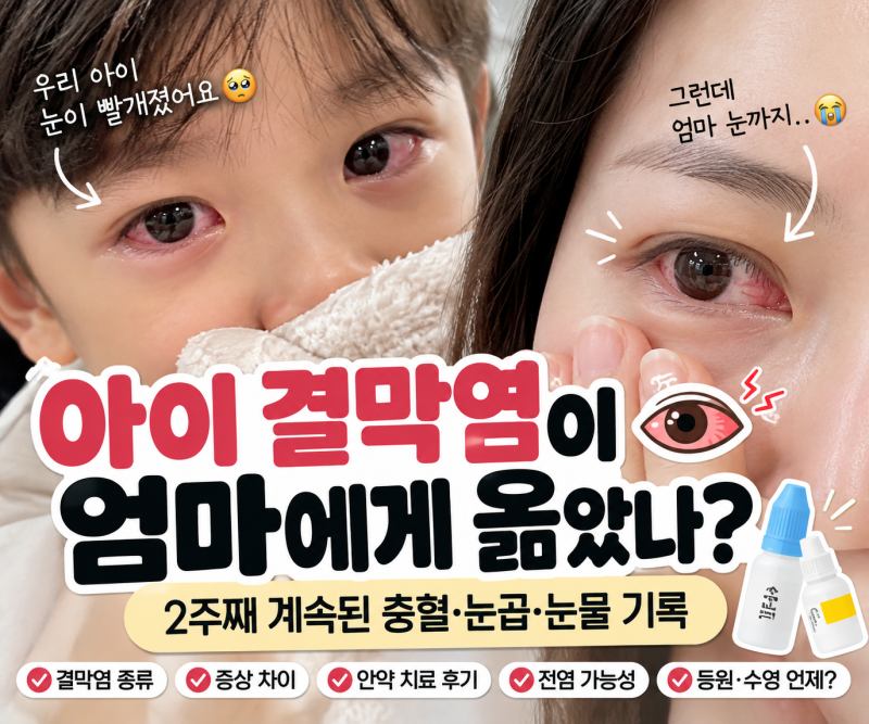 아이 결막염 2주째? 충혈·눈곱이 계속될 때｜알레르기성·감염성 결막염 차이와 실제 치료 ....