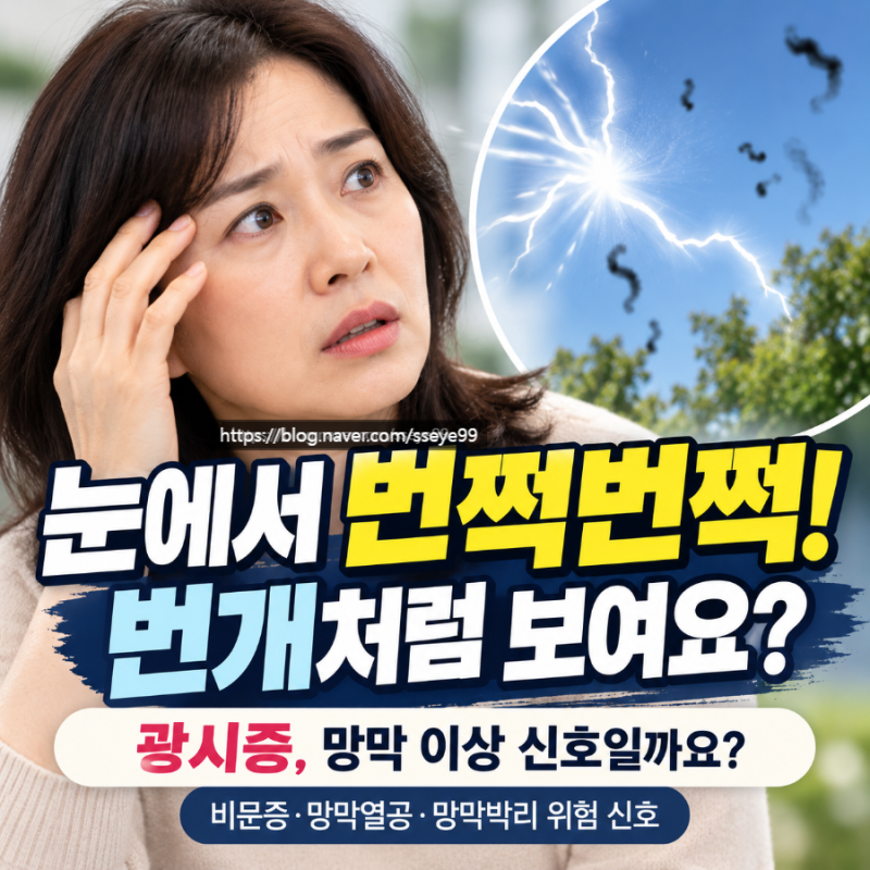 송탄 안과 : 눈에서 번쩍번쩍 번개처럼 보여요? 광시증 원인부터 비문증·망막열공·망막박리....