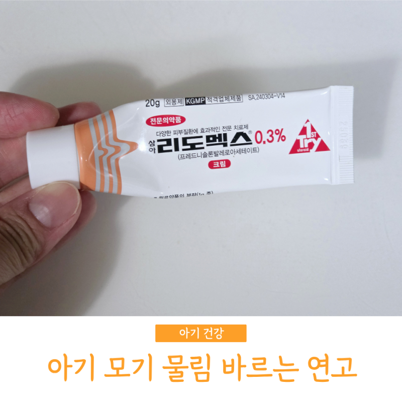아이 모기 물렸을 때 연고 대처 방법 바르는 약 스테로이드 리도멕스