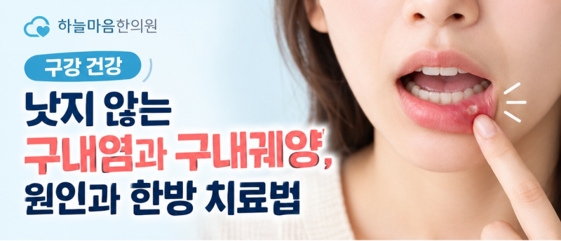 [구강 건강] 낫지 않는 구내염과 구내 궤양, 원인과 한방 치료법 - 청주 하늘마음한의원