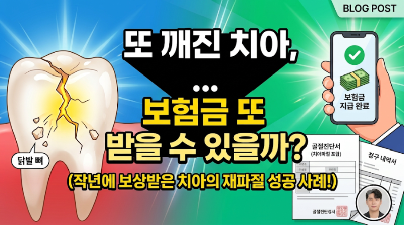 작년에 깨졌던 치아가 또 깨졌는데… 보험금 또 받을 수 있을까? (동일 치아 재파절 청구 후....