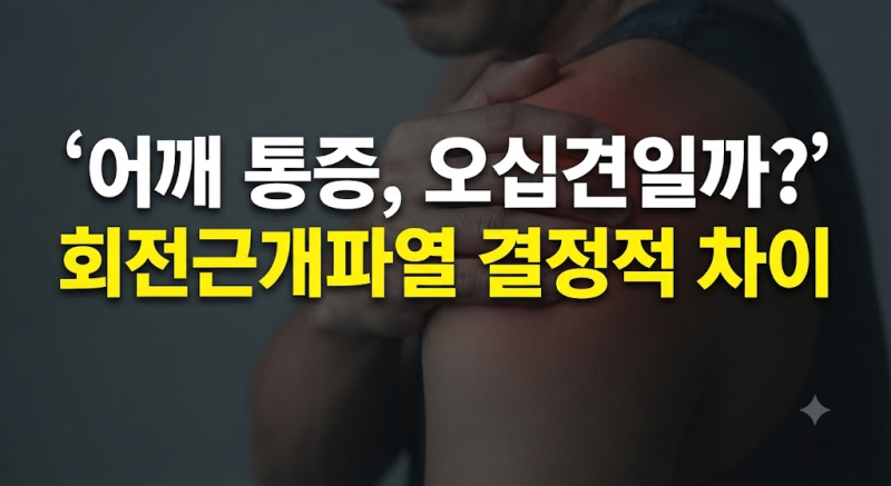 오십견 통증 증상과 원인, 치료는 어떻게? 회전근개파열 증상과 차이 3가지