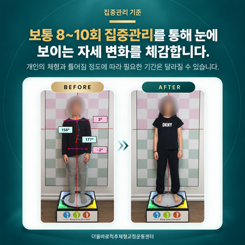 강동구 어린이 굽은등 자세교정, 실패 없는 선택을 위한 4가지 기준