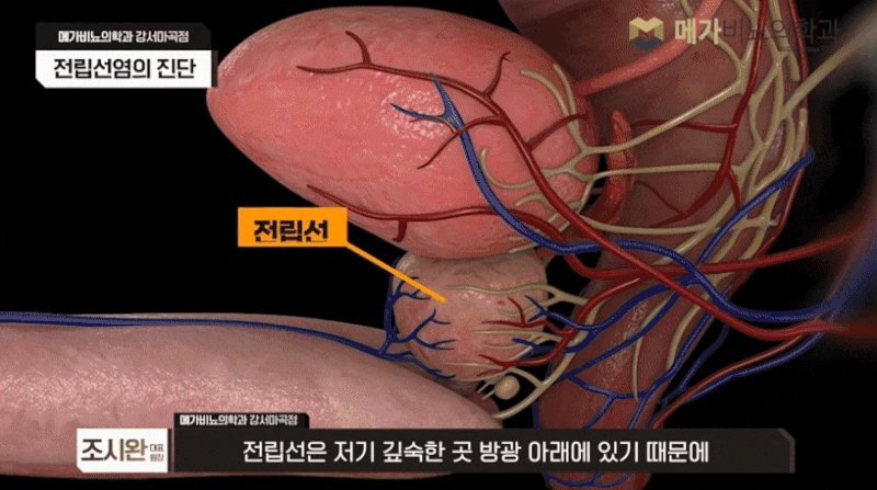 전립선초음파 검사 결과에 따라 치료 방법은 달라질 수밖에 없습니다