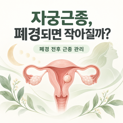 자궁근종, 폐경되면 저절로 작아질까?｜폐경 전후 근종 관리